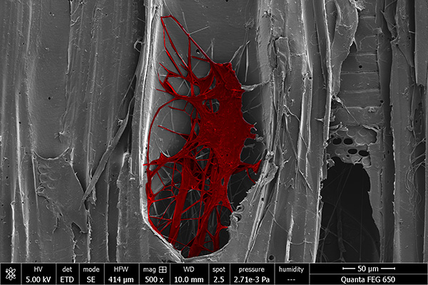 Microscope image of a wood decomposing fungus within poplar vessels